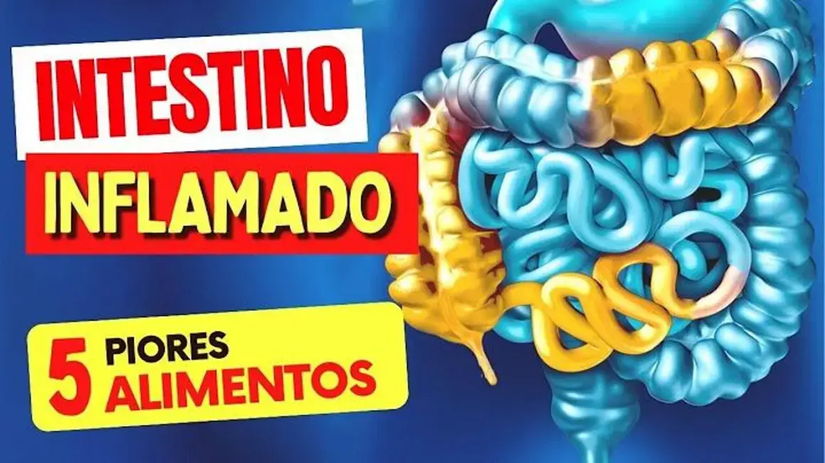 Receita de Alimentos Inflamatórios: Troque por Esses para Melhorar Seu Intestino