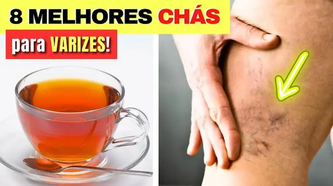 Receita de chá para varizes: 8 opções que aliviam e trazem bem-estar