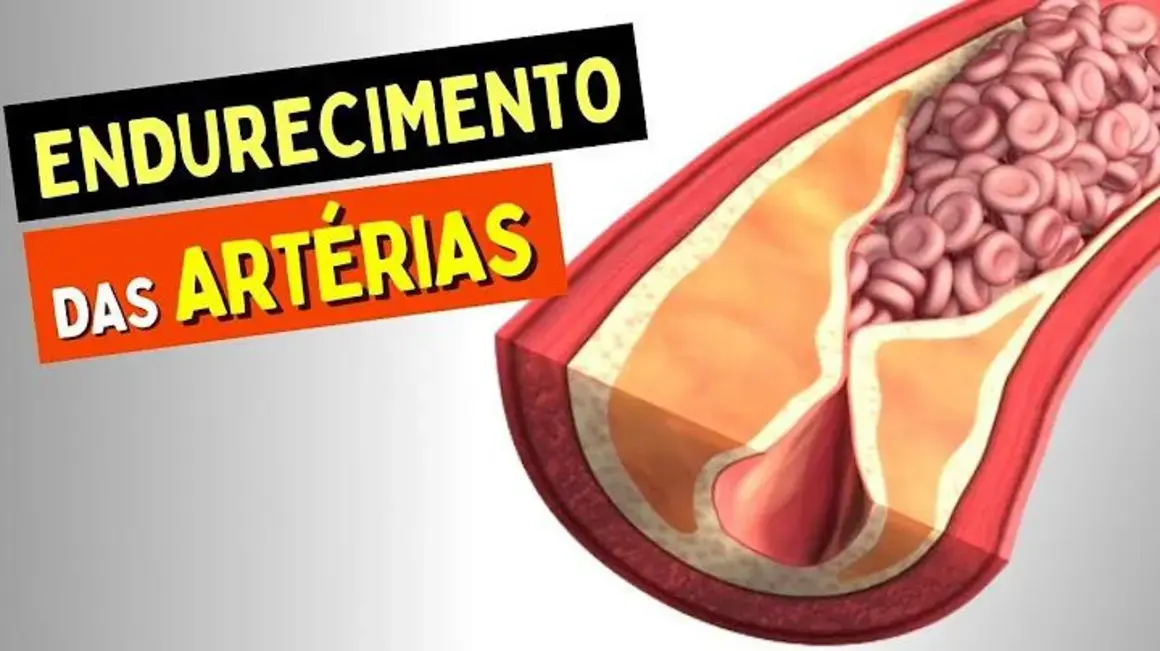 Receita de Endurecimento das Artérias: O Que Mudar Para Melhorar Minha Saúde